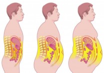 什么是内脂肪 先长皮下脂肪还是内脏脂肪