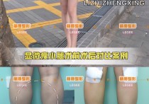 吃什么 做什么能减小腿 不吃什么瘦小腿最快最好