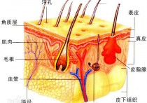 橘皮脂是什么 橘皮状皮肤早期图片