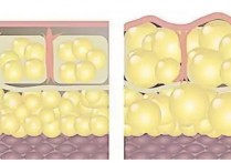 脂肪有什么构成 脂肪是怎么组成的