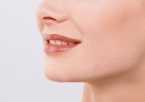 唇系带手术后吃什么 唇系带切除术的术后注意事项