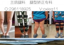 怎么知道自己腿什么型 什么样的腿型是正常的