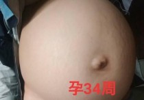 肚子凸起来什么原因 无缘无故长了小肚腩