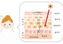 什么激光对于雀斑有效果 激光祛雀斑正确的方法