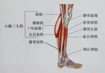 脂肪腿是什么 有什么好方法分辨脂肪腿和肌肉腿？